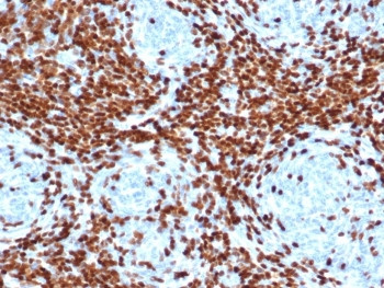 Anti-TdT / DNA nucleotidylexotransferase, clone DNTT/4506R