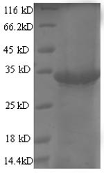 Single-stranded DNA-binding protein gp2.5(2.5), Enterobacteria phage T7, recombinant