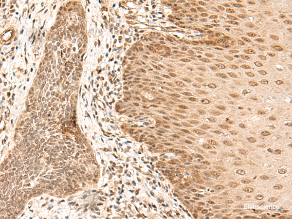 Anti-ARMC8