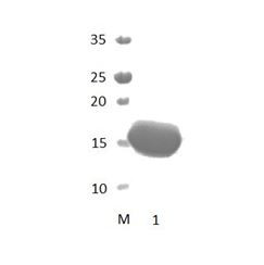 PDZD4 PDZ Domain