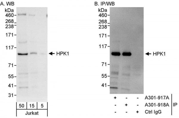 Anti-HPK1