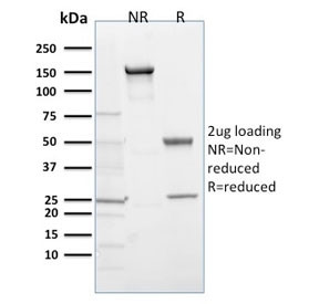 Anti-EGLN1 / PHD2, clone 366G/76/3