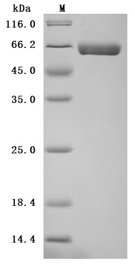 Alkaline phosphatase, germ cell type (ALPG) (Active), human, recombinant