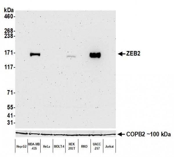 Anti-ZEB2/SIP Recombinant Monoclonal