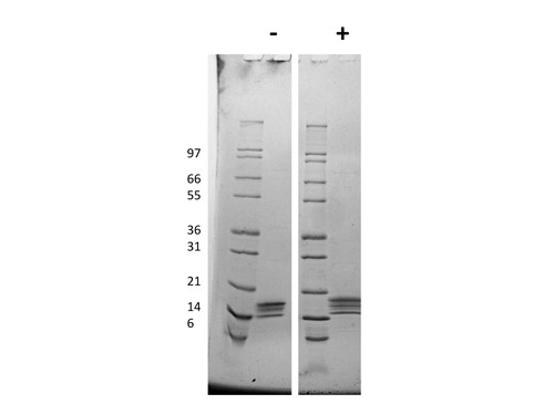 Thrombopoietin