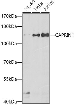 Anti-CAPRIN1