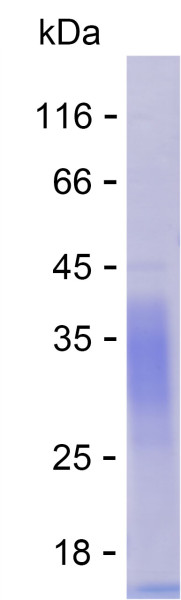 Recombinant Human INSL6 Protein
