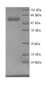 Aerobic glycerol-3-phosphate dehydrogenase (glpD), Escherichia coli, recombinant