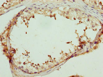 Anti-LRRC18