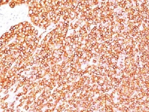 Anti-CD45 (Leukocyte marker), clone SPM570