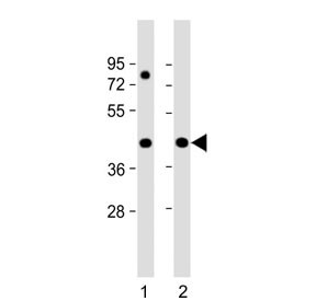 Anti-Pre-mRNA-splicing factor 38A / PRPF38A