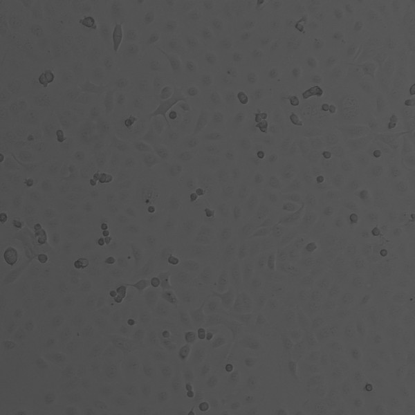 TE-1 Cells
