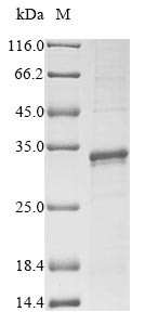 60S ribosomal protein L10 (RpL10), Drosophila melanogaster, recombinant