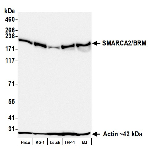 Anti-SMARCA2/BRM Recombinant Monoclonal