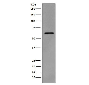 Anti-phospho-Src / Phospho-Y419, clone DDH-19