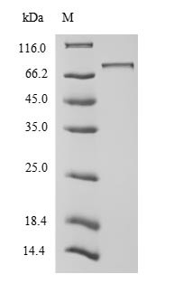 Nucleolar transcription factor 1 (UBTF), human, recombinant