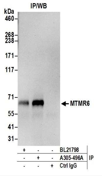 Anti-MTMR6