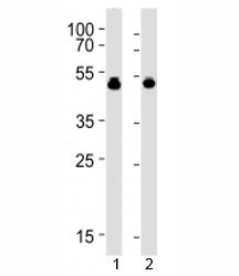 Anti-VASP