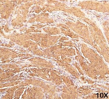 Anti-Actin Muscle Specific, clone HHF35