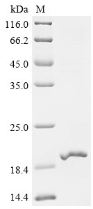 E3 ubiquitin-protein ligase RNF128 (RNF128), partial, human, recombinant