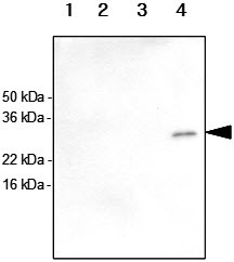 Anti-KIR2DS4, clone 5F2