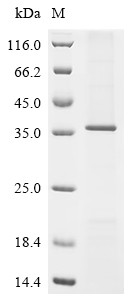 Zinc transporter ZIP6 (Slc39a6), partial, rat, recombinant