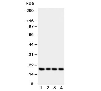 Anti-IFN-gamma