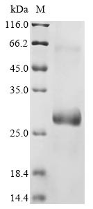 Protein PML (Pml), partial, mouse, recombinant