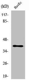 Anti-B3GALT1