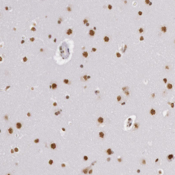 Anti-HNRNPH2