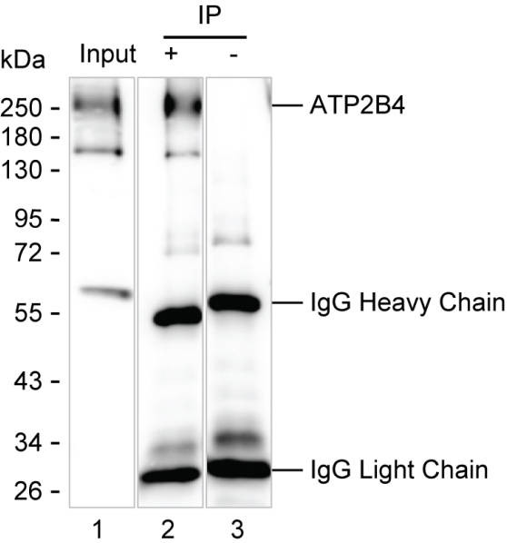 Anti-ATP2B4