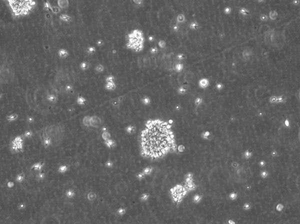 B-LCL-HROC103 Cells