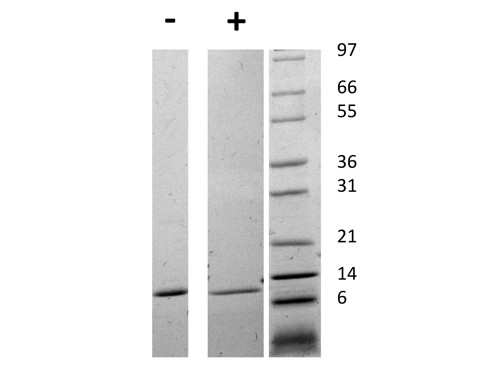 Migration Inhibitory Factor