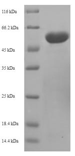 2-oxoglutarate dehydrogenase, mitochondrial (Ogdh),partial, mouse, recombinant