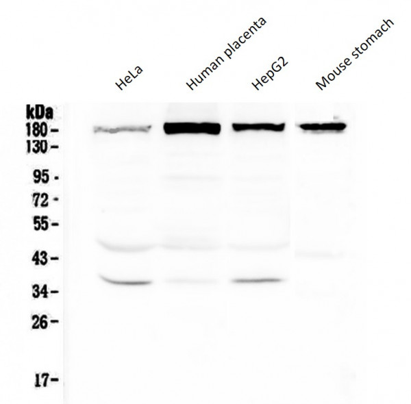 Anti-IQGAP2