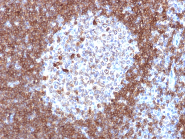Anti-CD79a (B-Cell Marker), clone JCB117