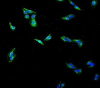 Anti-Beta Tubulin / TUBB, clone 5E4.