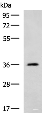 Anti-ATP1B2