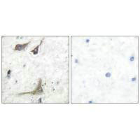 Anti-PTGS1
