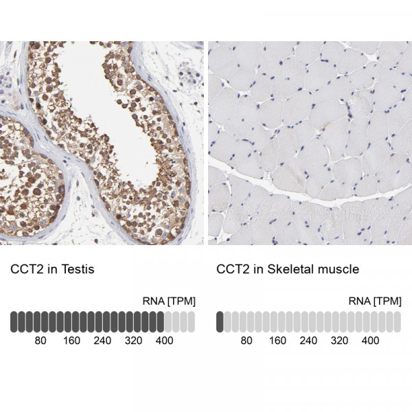Anti-CCT2