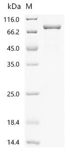 Multiple inositol polyphosphate phosphatase 1 (MINPP1), recombinant human