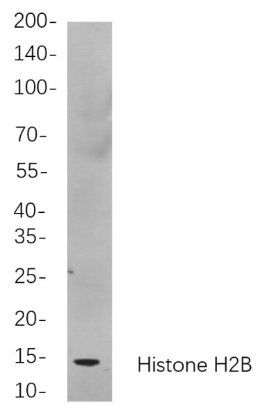 Anti-Recombinant Histone H2B, clone 9C9