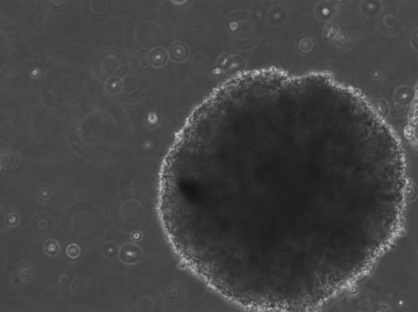 B-LCL-HROC75 Cells