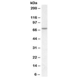 Anti-MTM1