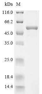 D-3-phosphoglycerate dehydrogenase (PHGDH), partial, recombinant human