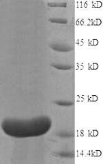 Interleukin-18-binding protein (IL18BP), partial, human, recombinant