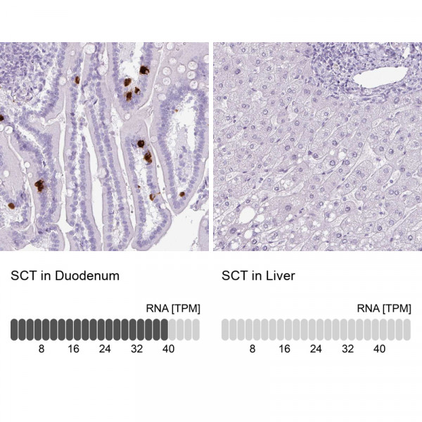 Anti-SCT
