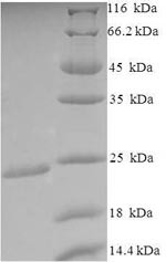 Outer-membrane lipoprotein carrier protein (lolA), Escherichia coli O9:H4, recombinant