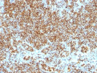 Anti-CD45 / LCA (Leucocyte Marker)(SPM569 + SPM570)