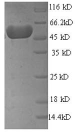 Mannose-6-phosphate isomerase (manA), Escherichia coli, recombinant